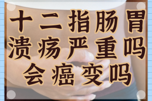 “疫情地区可以买胃药吗” 疫情期间买胃药会被隔离吗？