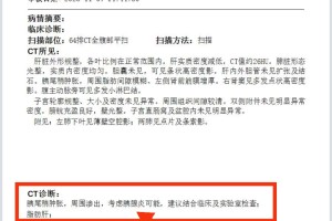 疫情进展地区怎么查询的-疫情地区查询在哪查